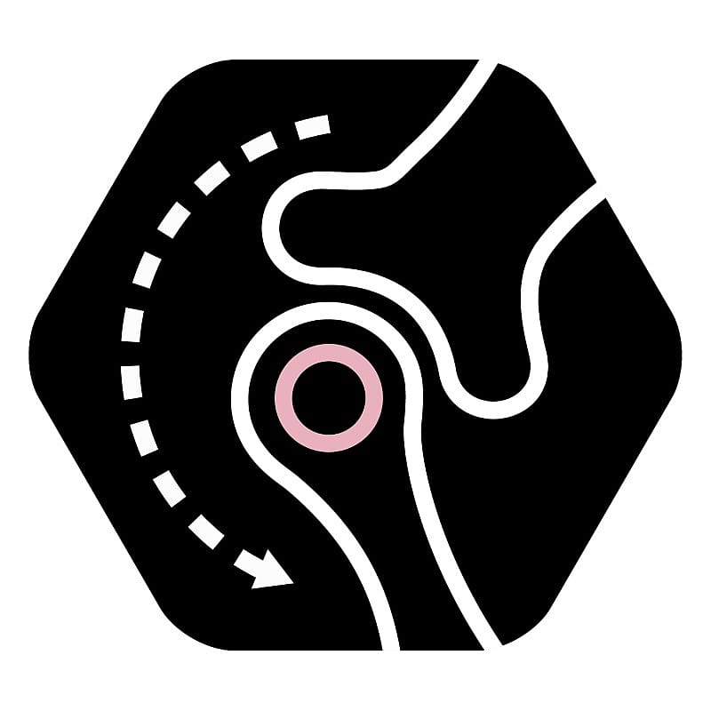 Purina Pro Plan Large Robust Adult Sensitive Skin Hondenvoer 14 kg