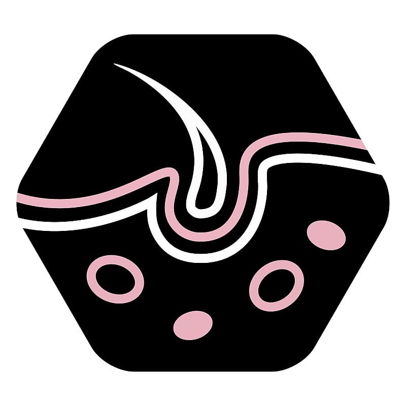 Purina Pro Plan Large Robust Adult Sensitive Skin Hondenvoer 14 kg